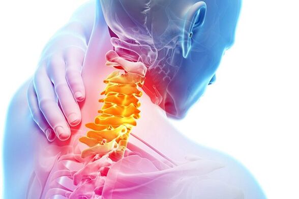 Causes of cervical osteochondrosis
