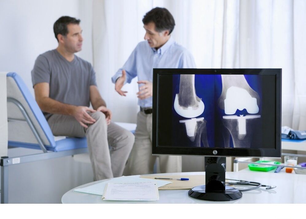 Knee joint arthrosis in X -Ray photo
